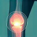 Illustration showing protective joint